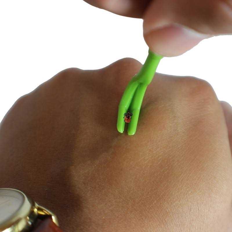 3 Pack Tick Remover Tools + Tick Identification Card W97975